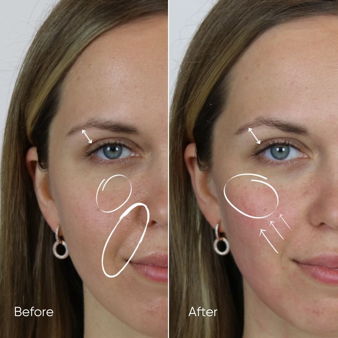 Zemits HydroVerstand PRO Sistema HydroDiamond™ 7 en 1